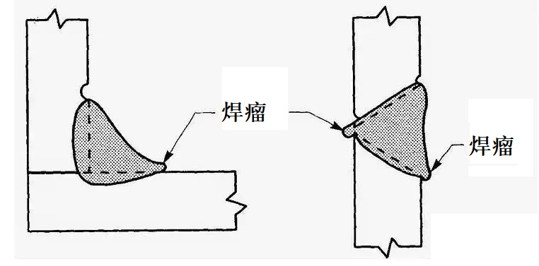 焊瘤